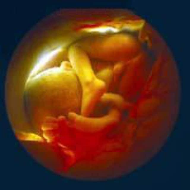 Фото ребенок рожденный в 34 недели беременности