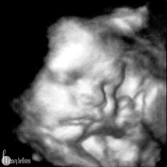 Малыш на 32 неделе. УЗИ 32 недели беременности. Снимок УЗИ 32 недели беременности. 3д УЗИ на 32 неделе беременности. 32 Недели беременности фото плода на УЗИ.