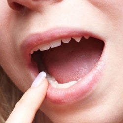 Заболевание крови, проявления в полости рта